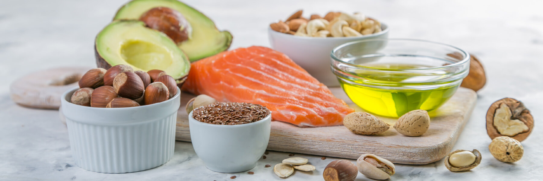 Cum să menţineţi un nivel corespunzător de colesterol?